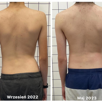 Agnieszka Marchlewska, Gdańsk Фото - 5