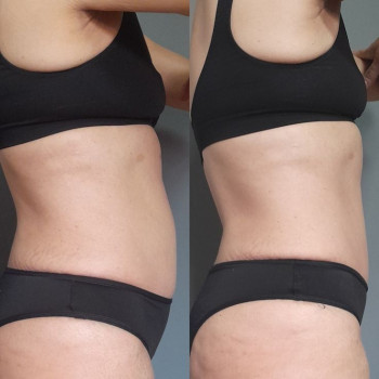 Ashley Betterton, Лос-Анджелес Фото - 6