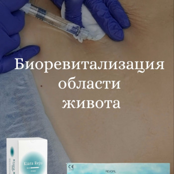 Svetlana Tsarenko, Warsaw Фото - 49