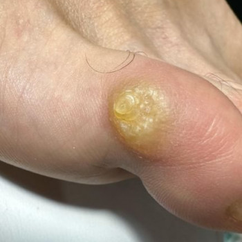 Валентина , Гданьск Фото - 5