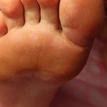 Виктория Степанчук, Лодзь Фото - 21