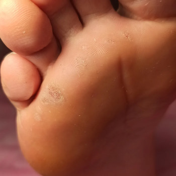 Виктория Степанчук, Лодзь Фото - 22