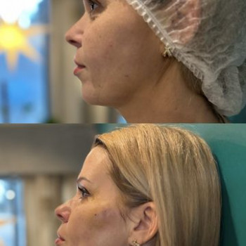 Петр Майковски, Гданьск Фото - 5