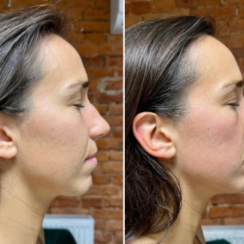 Justyna Derzyńska, Łódź Фото - 5