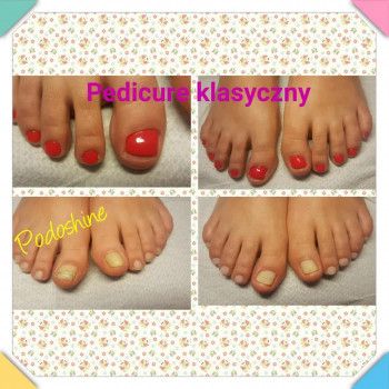 Katarzyna Frydrych, Lodz Фото - 5