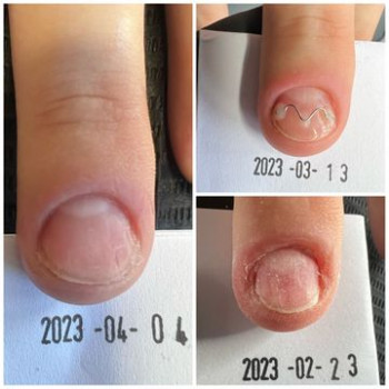 Dominika Przybysz, Lodz Фото - 5