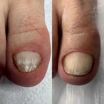 Patrycja Jaworska, Lodz Фото - 6