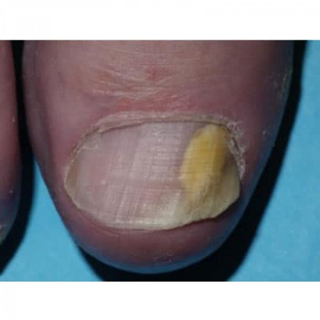 Monika Pietraszkiewicz, Lodz Фото - 6