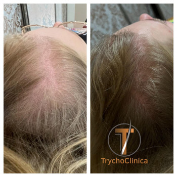 Magdalena Wojtaszewska, Lodz Фото - 5