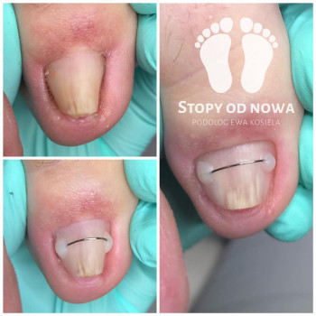 Ewa Kosiela, Warszawa Фото - 5