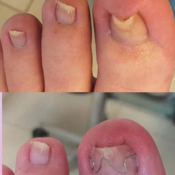 Anna Traczyk, Warszawa Фото - 5