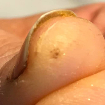 Katarzyna Rytel, Warsaw Фото - 5