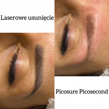 CAPRISE, Варшава Фото - 16