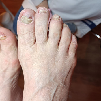 Божена Вишневска, Варшава Фото - 5