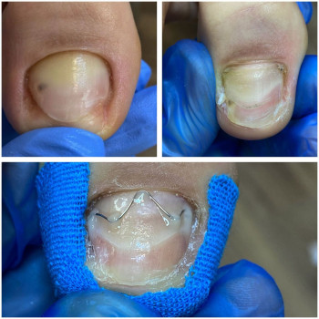 Inna Dyachuk, Warszawa Фото - 5