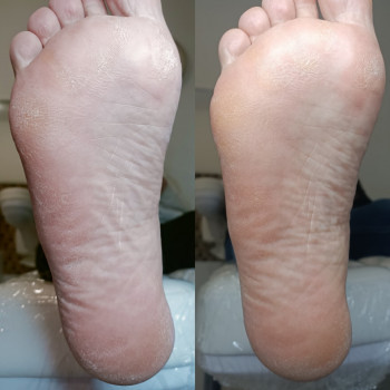 Катажина Галазка, Варшава Фото - 6