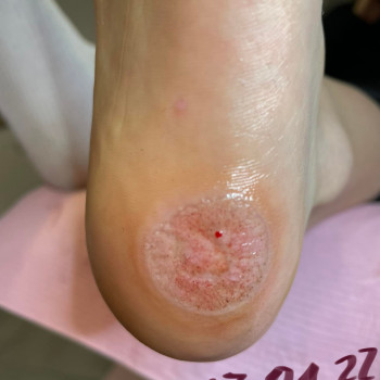 Małgorzata Bartkowska, Bydgoszcz Фото - 5