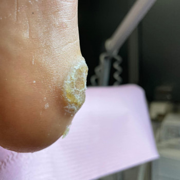 Małgorzata Bartkowska, Bydgoszcz Фото - 6