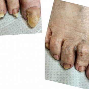 Agnieszka Szachniewicz, Bydgoszcz Фото - 5