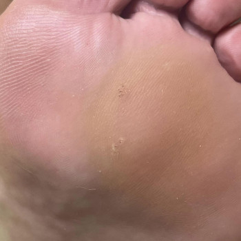 Anna Razanava, Bydgoszcz Фото - 5