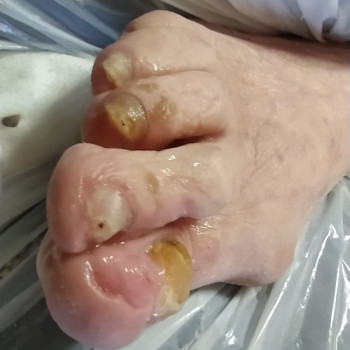 Podologia Mobilna, Быдгощ Фото - 6