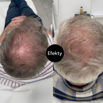 Anna Talarek, Lodz Фото - 5