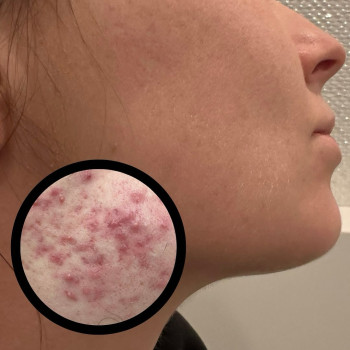 Anna Talarek, Lodz Фото - 6