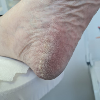 Denys Dobrovolskyi, Krayot Фото - 5