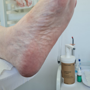 Denys Dobrovolskyi, Krayot Фото - 6