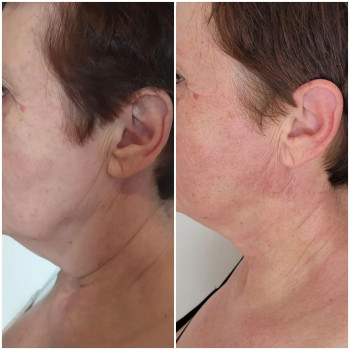 Anna Stefańska, Łódź Фото - 5