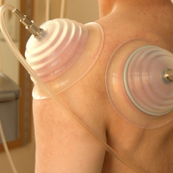 Witold Słomko, Bydgoszcz Фото - 5