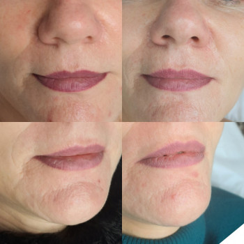 Александра Оливковска, Быдгощ Фото - 5