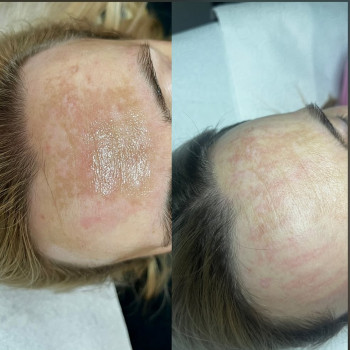 Roksana Suwik, Bydgoszcz Фото - 6