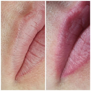 Удаление некачественного перманента 1 процедура