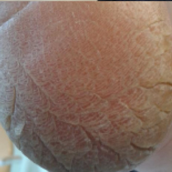 Marzena Torczyk-Piasecka, Lublin Фото - 5