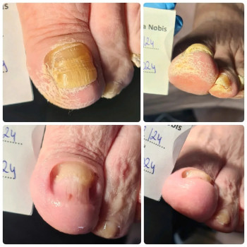 Anna Nobis, Lublin Фото - 5