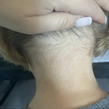 Angelina Jóźkiewicz-Harytanowicz, Lublin Фото - 5