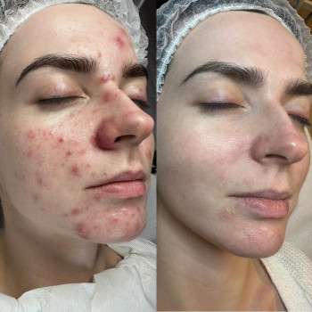 Магдалена Гасинская, Люблин Фото - 6