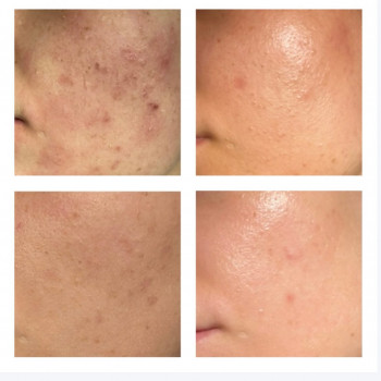 Roksana Wicherek, Rybnik Фото - 5