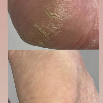 Юлия Устина, Krasnodar Фото - 7