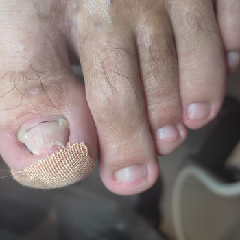 Yuliia Holoporova, Вроцлав Фото - 6