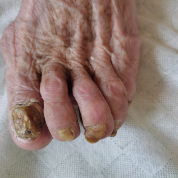 Yuliia Holoporova, Вроцлав Фото - 8