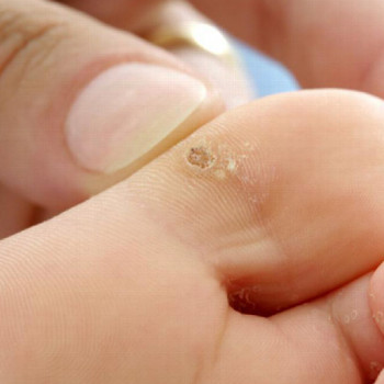 Yuliia Holoporova, Вроцлав Фото - 9