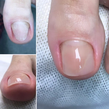 Yuliia Holoporova, Вроцлав Фото - 11