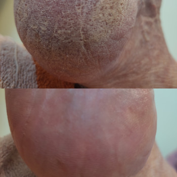 Yuliia Holoporova, Вроцлав Фото - 13