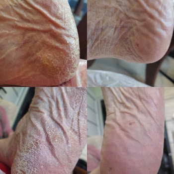 Yuliia Holoporova, Вроцлав Фото - 14