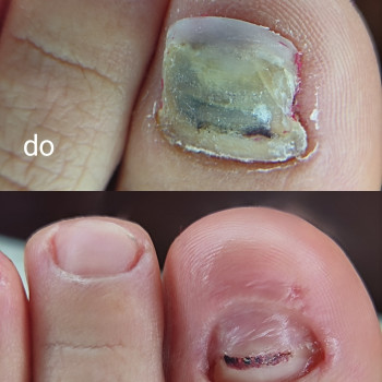 Yuliia Holoporova, Вроцлав Фото - 15