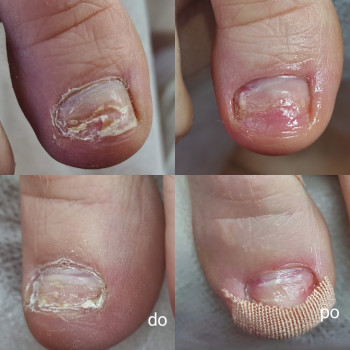 Yuliia Holoporova, Вроцлав Фото - 16