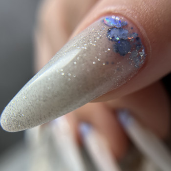 Коррекция анихогрифоза