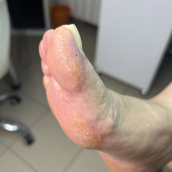 Положительные динамики за пару посещений